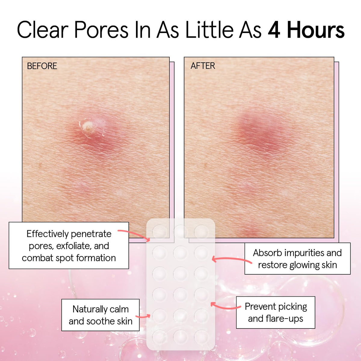 grace & stella patch applied to cheek showing discreet protection benefit
