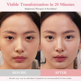 GrlGrl patch applied under eye demonstrating immediate de-puff benefit