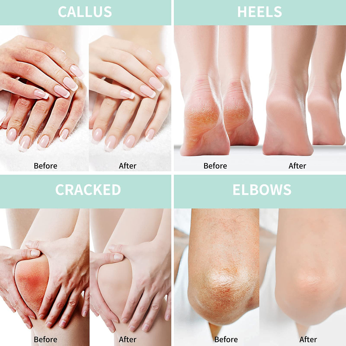 Grocerism used in a nighttime foot care routine, helps intensify softening