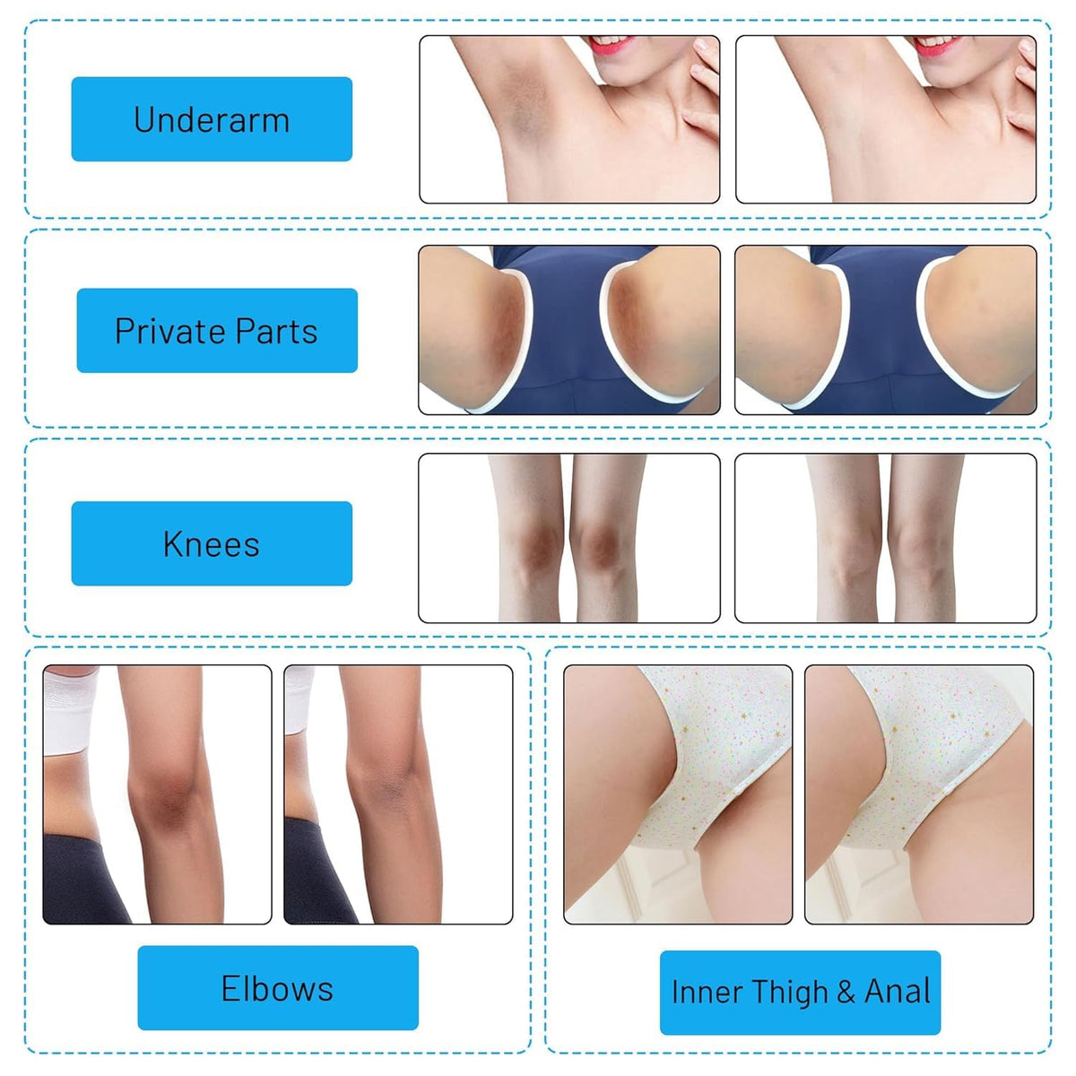Gukei application inner thigh demo showing gentle spot treatment