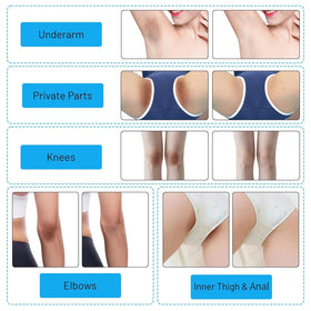 Gukei application inner thigh demo showing gentle spot treatment