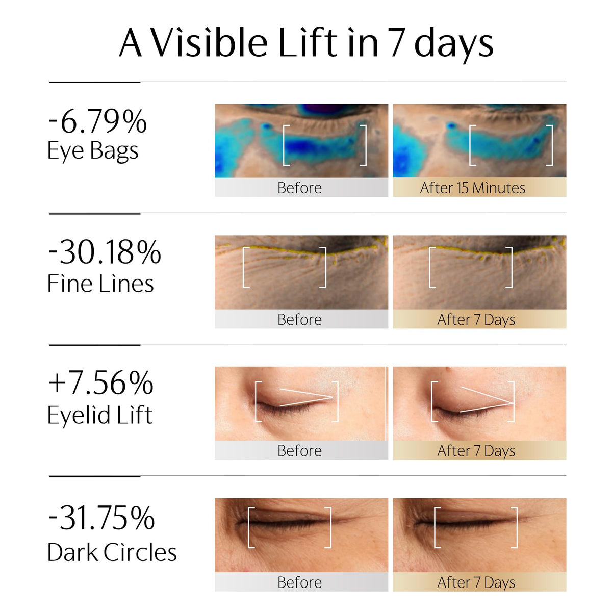 GUYU label close-up listing exosome, PDRN, caffeine and peptide actives