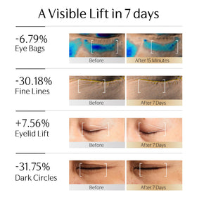 GUYU label close-up listing exosome, PDRN, caffeine and peptide actives