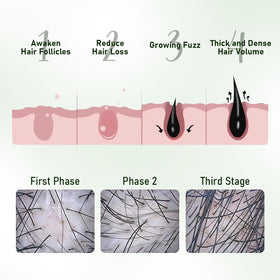 Gypsophila batana oil applied to scalp to improve moisture and manageability