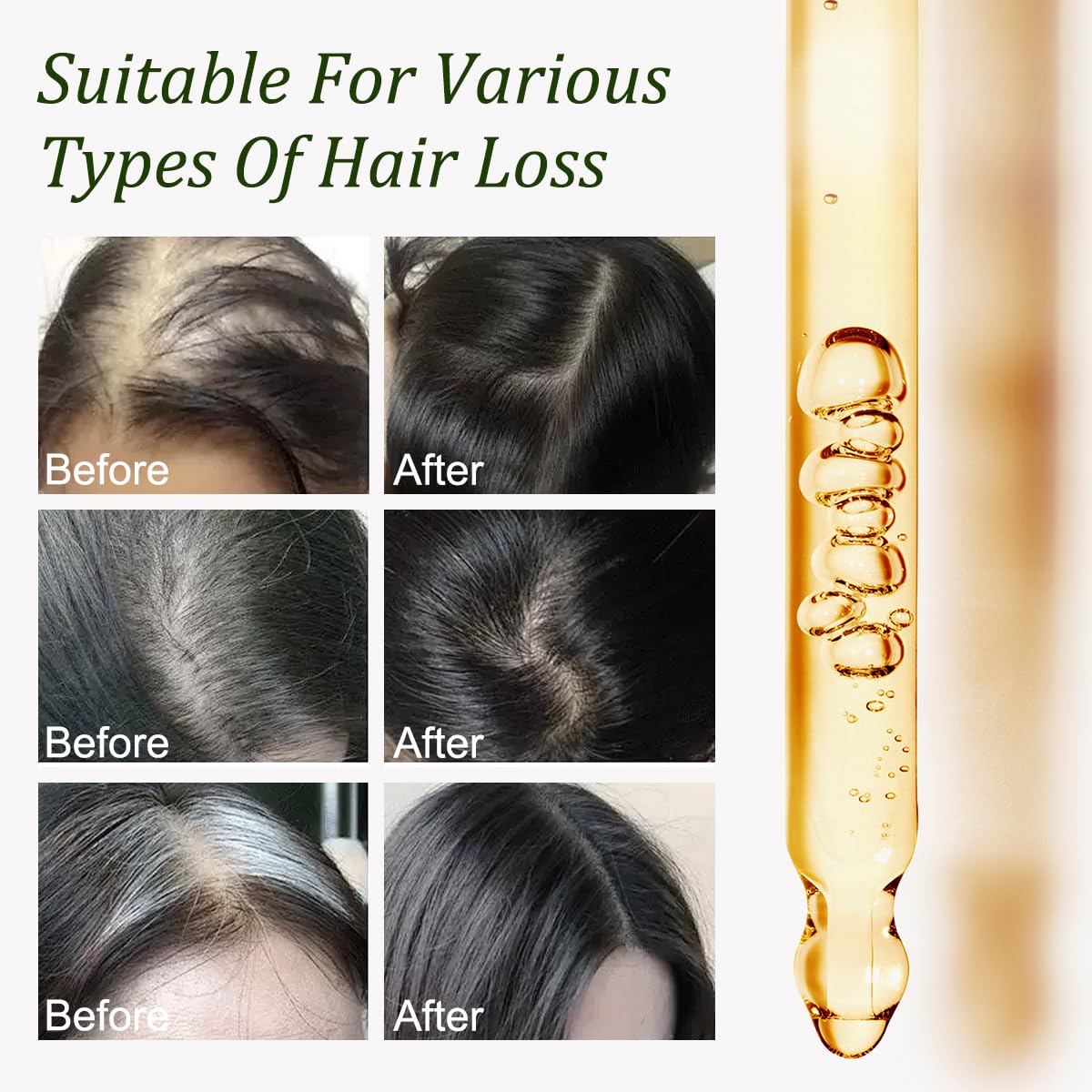Gypsophila oil being massaged into scalp to nourish roots and reduce breakage