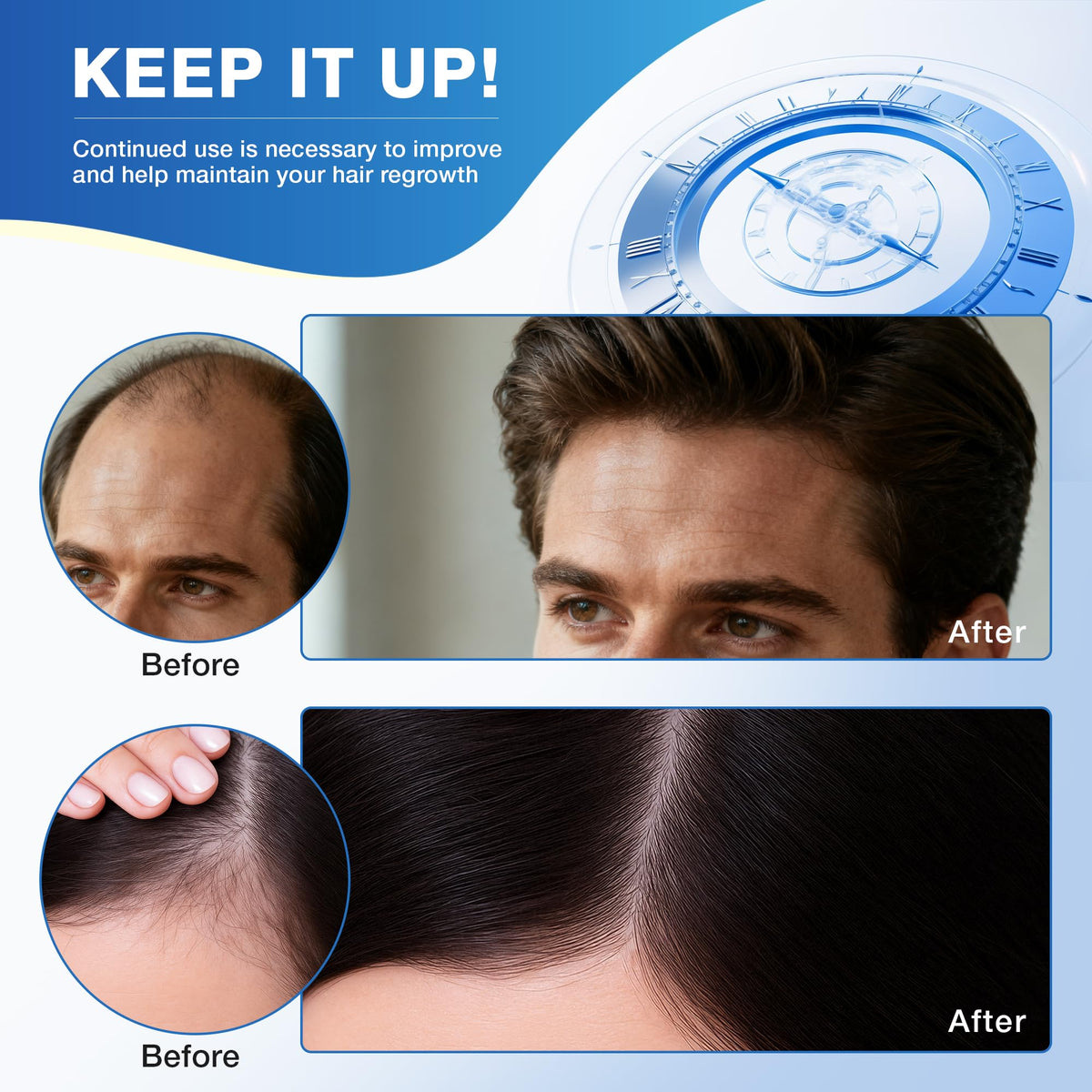 HairVibe label and ingredient panel closeup explaining active minoxidil and biotin