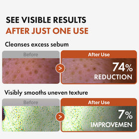 Hanskin texture drop on hand demonstrating lightweight oil absorption benefit