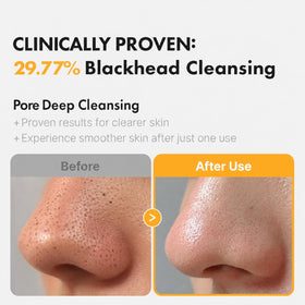 Hanskin pours lightweight cleansing oil close-up displaying smooth texture and easy spread