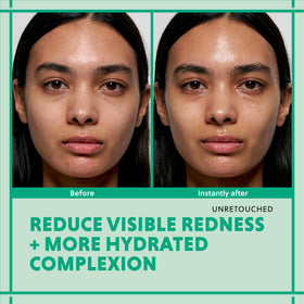 Before-and-after HANYUL showing visible cooling and reduced redness
