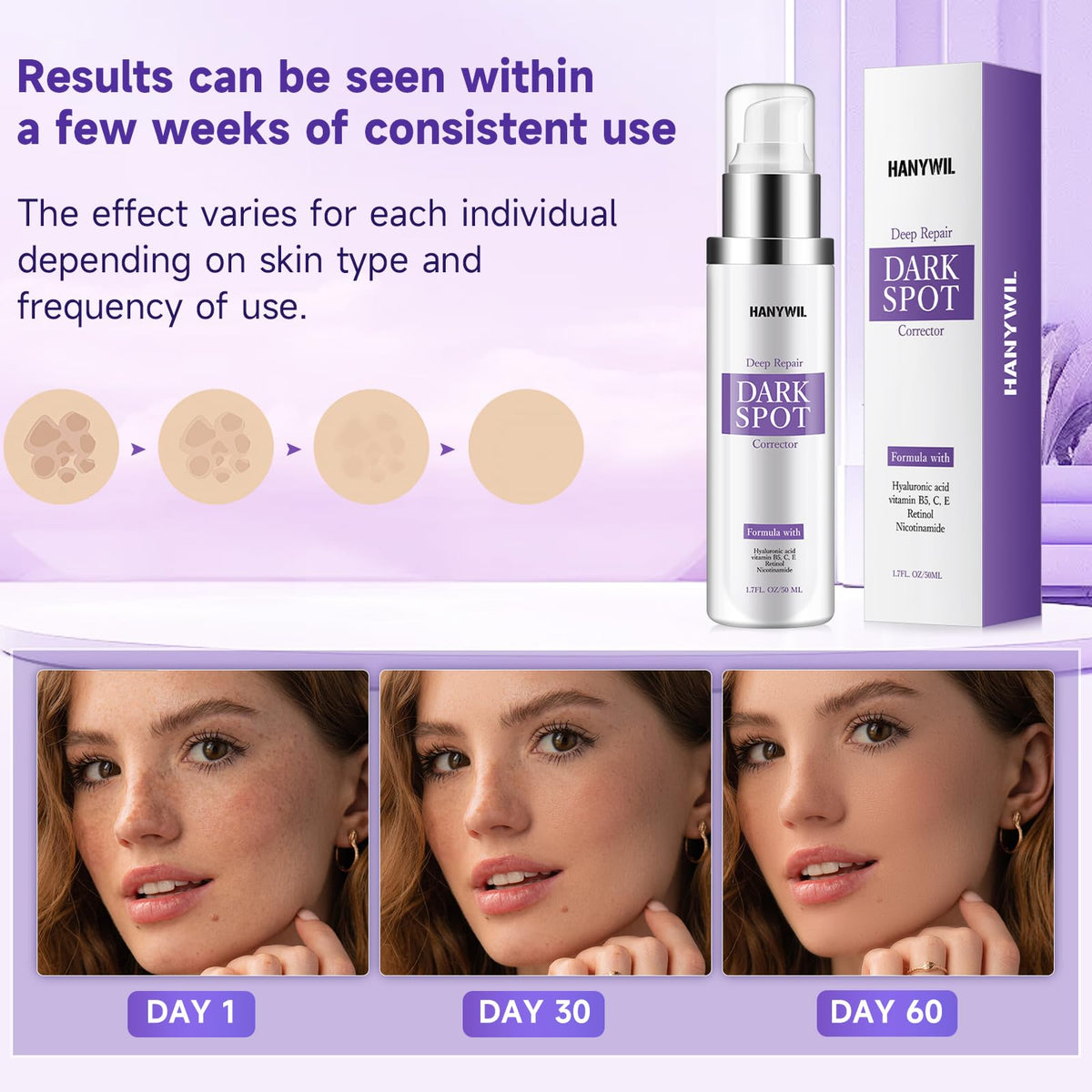 HANYWIL treating arm sun spot to even body skin tone benefit