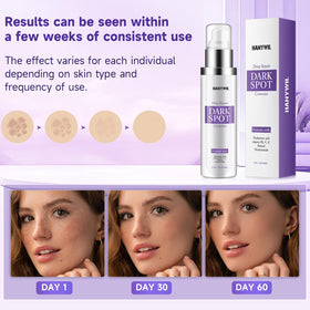HANYWIL treating arm sun spot to even body skin tone benefit
