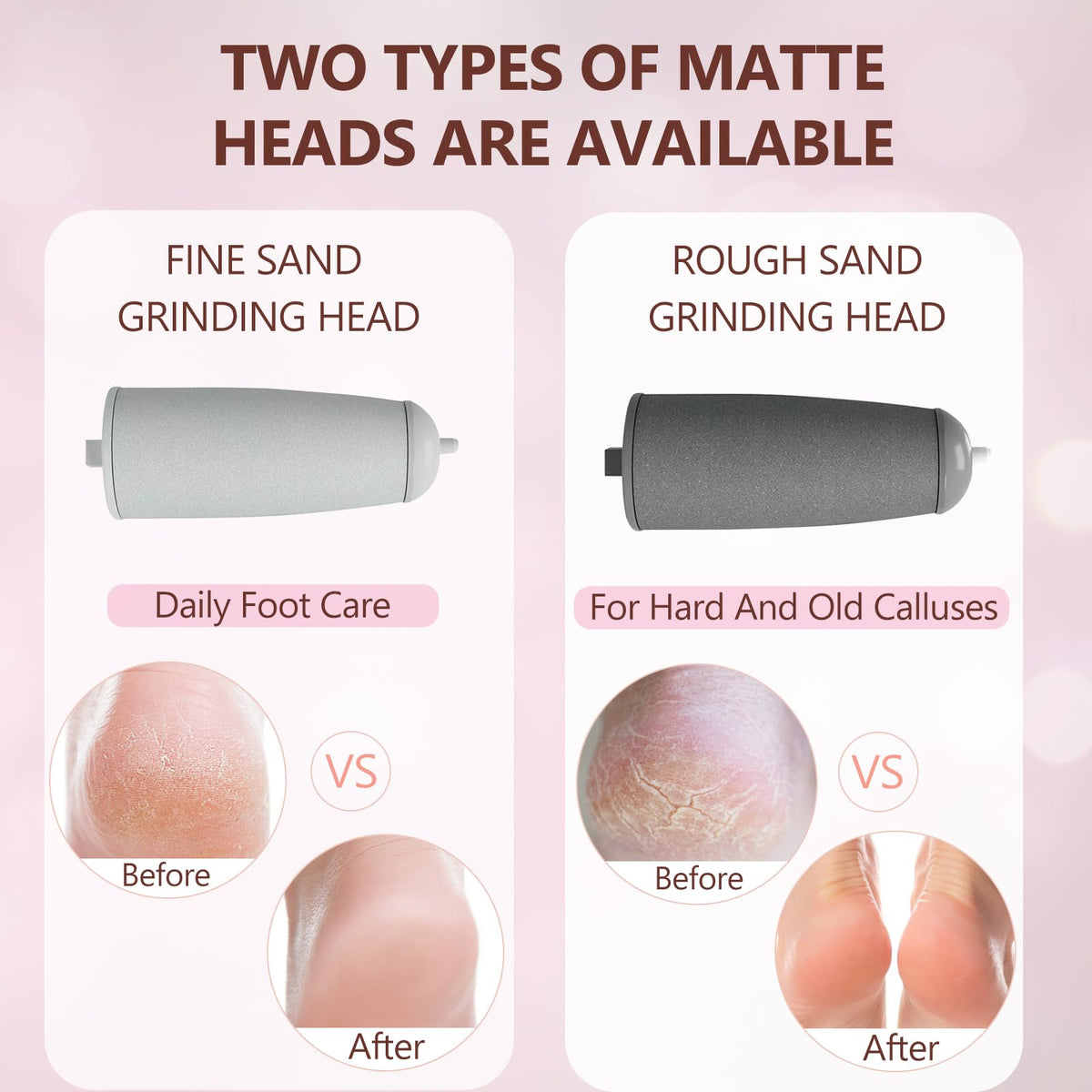 Haootadiy fine and coarse roller heads close-up for gentle or intensive exfoliation