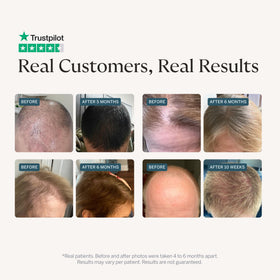 Happy Head label close-up highlighting ingredient names and supplement facts