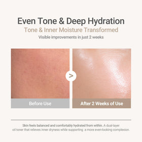 HAYEJIN before and after texture comparison on cheek, highlights smoother skin benefit