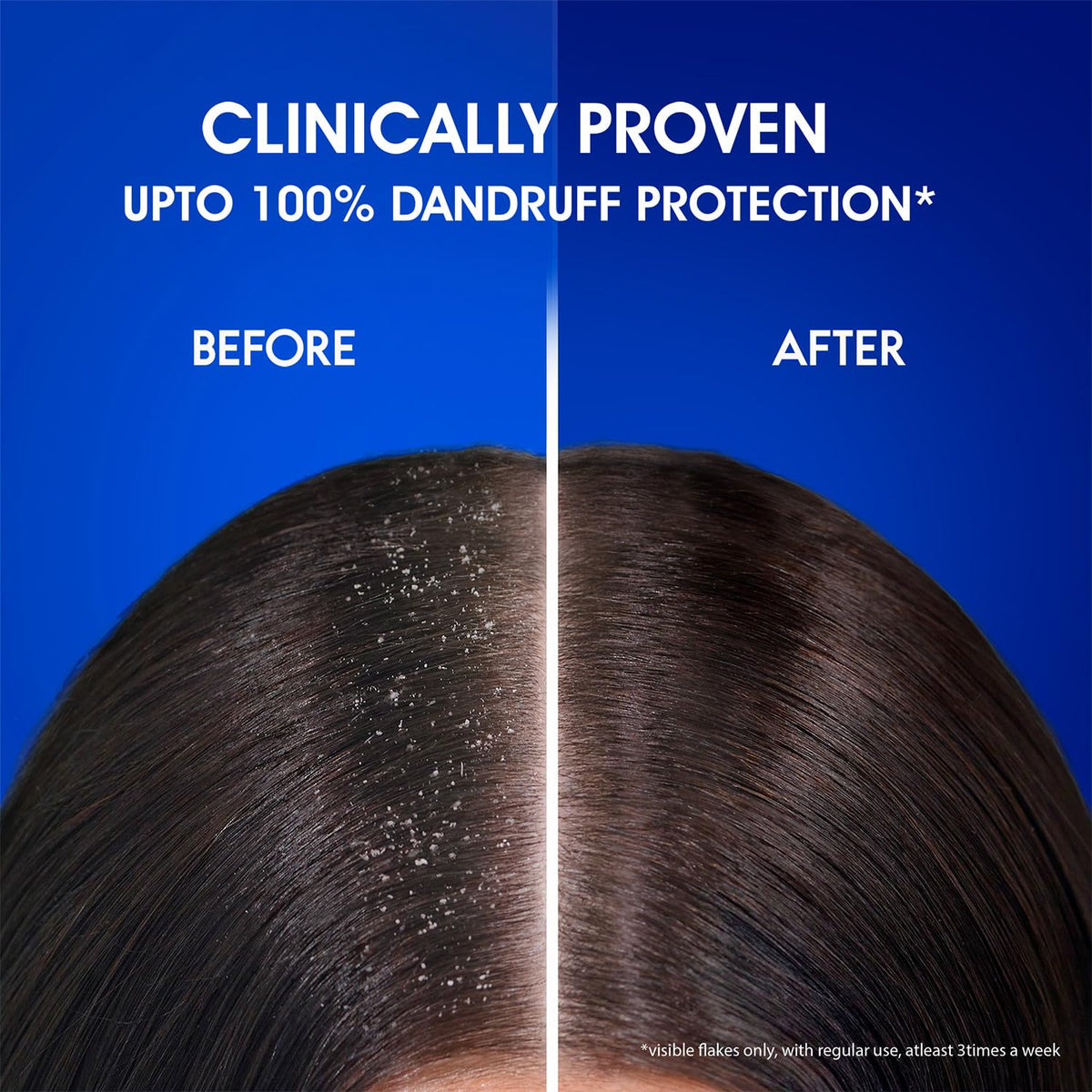 Head & Shoulders scalp before and after imagery showing reduced visible flakes benefit