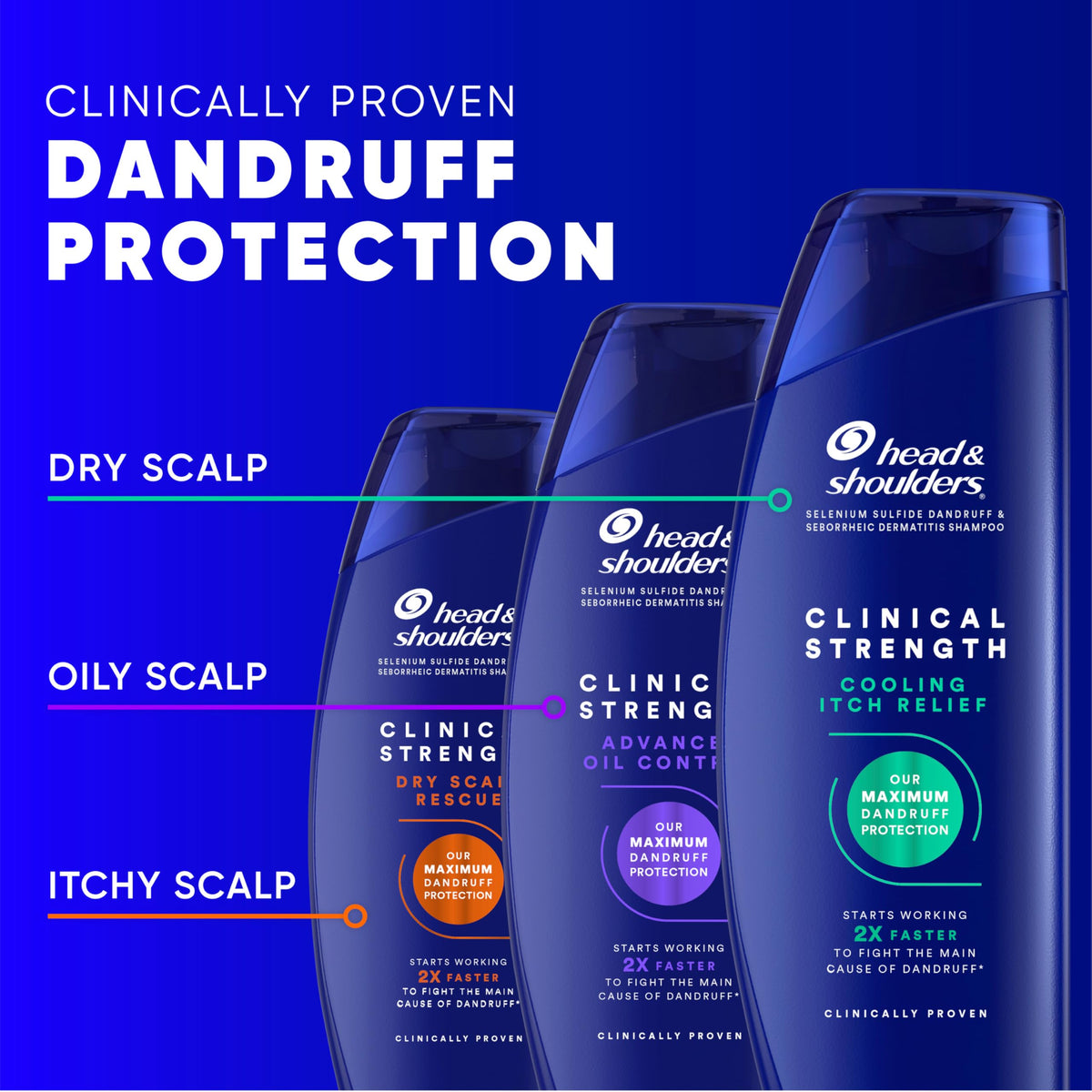 Head & Shoulders hair before and after comparison showing reduced visible flakes