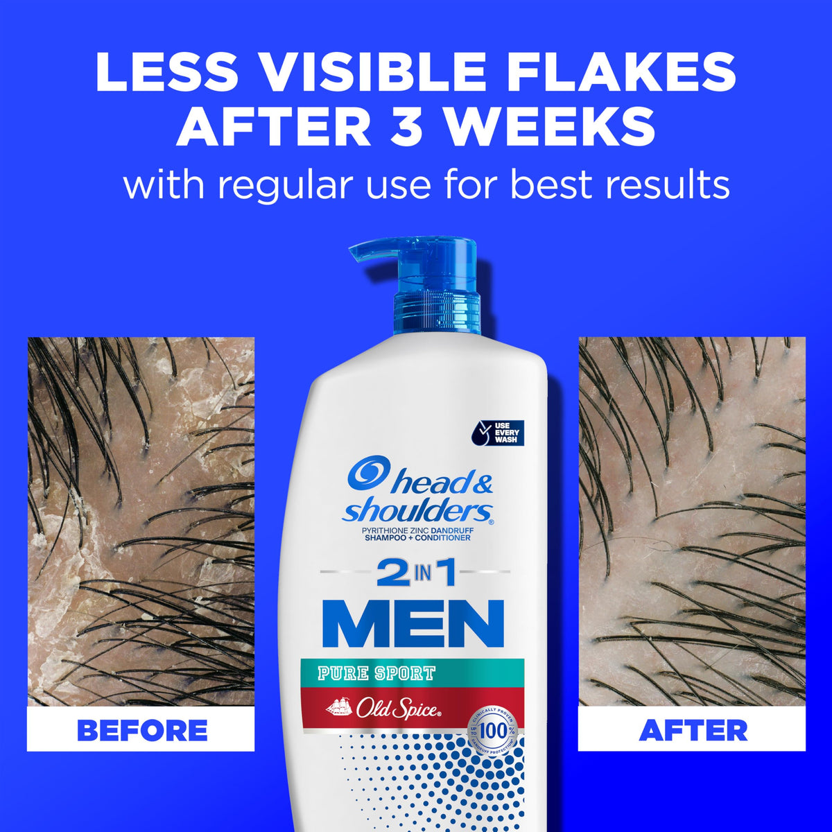 Head & Shoulders bottle in shower environment showing practical daily use