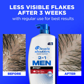 Head & Shoulders texture close‑up showing creamy 2‑in‑1 consistency for cleansing and conditioning