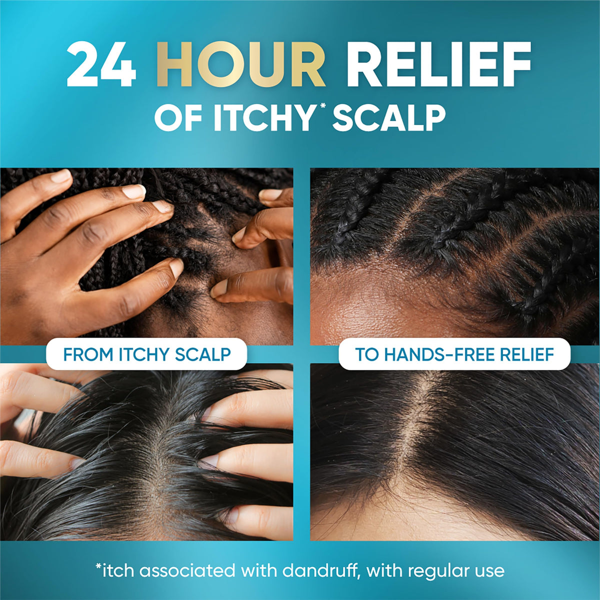 Applying Head & Shoulders elixir directly onto scalp, demonstrates soothing use between washes