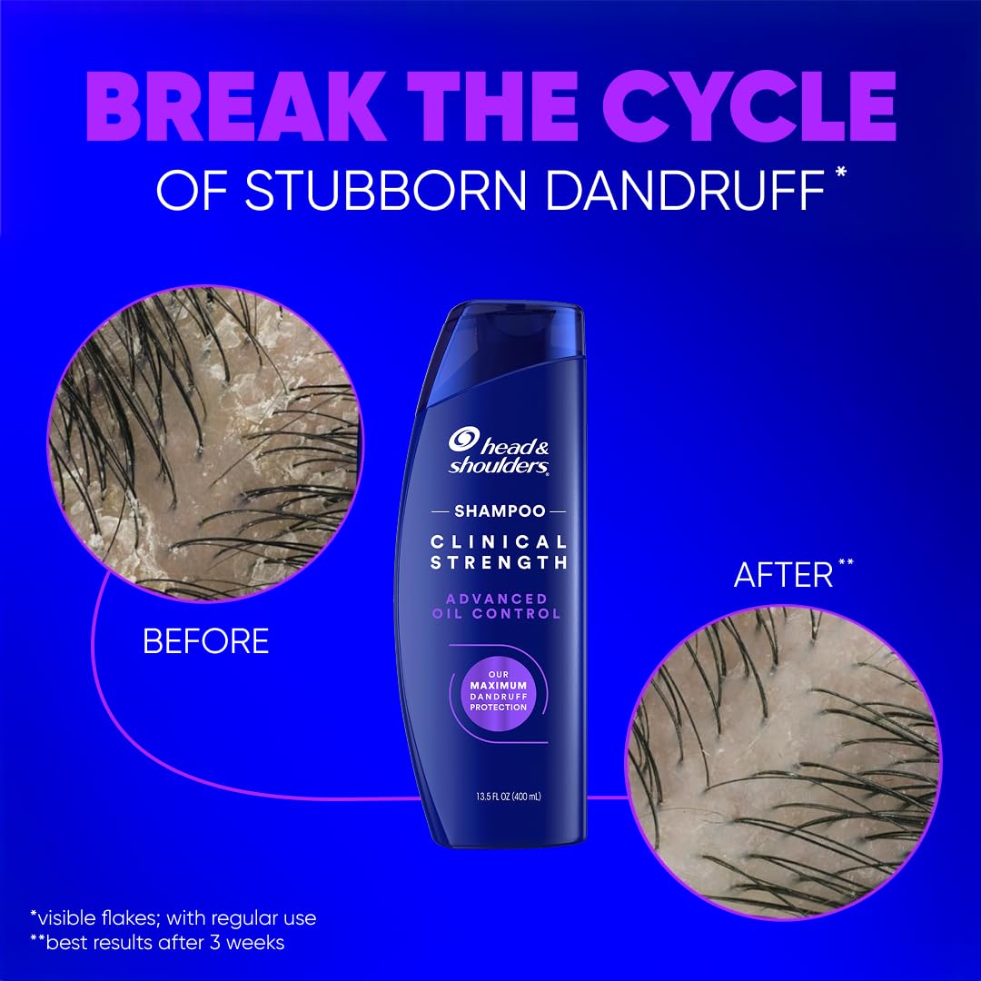 Head & Shoulders twin pack beside common bottle for scale and value benefit