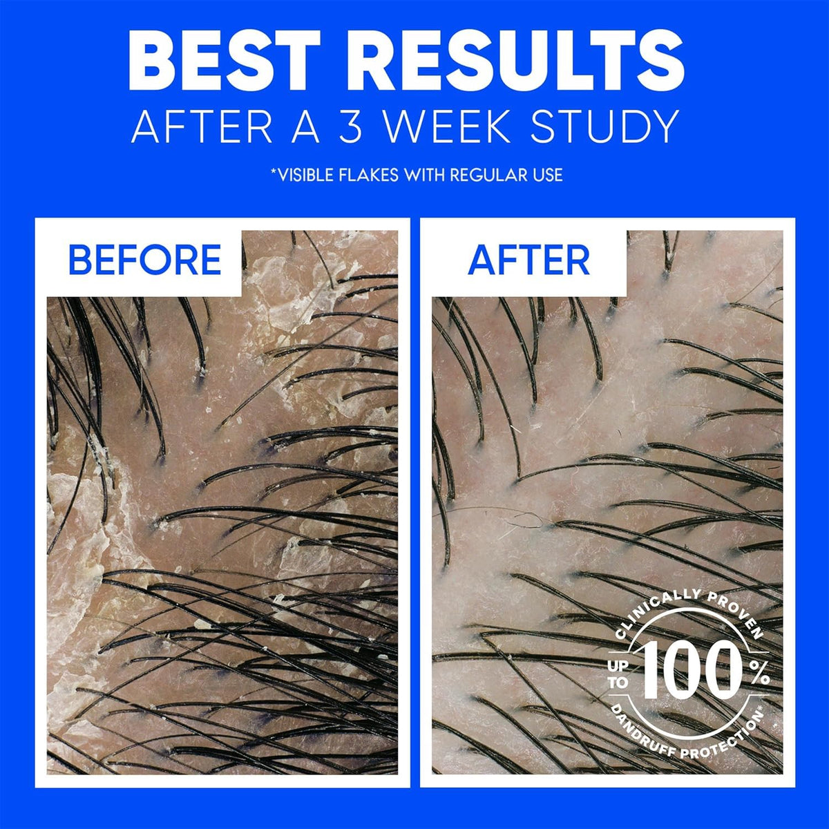 After-use on color-treated hair showing Head & Shoulders gentle cleanse and shine