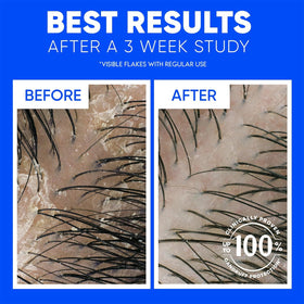 After-use on color-treated hair showing Head & Shoulders gentle cleanse and shine