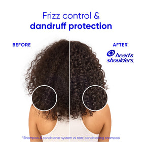 Head & Shoulders split view before and after using product showing fewer flakes