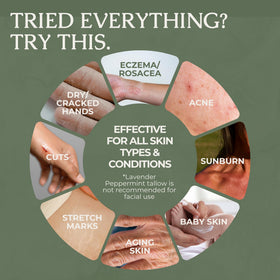 Hearth and Homestead hands applying balm to dry skin for long-lasting moisture