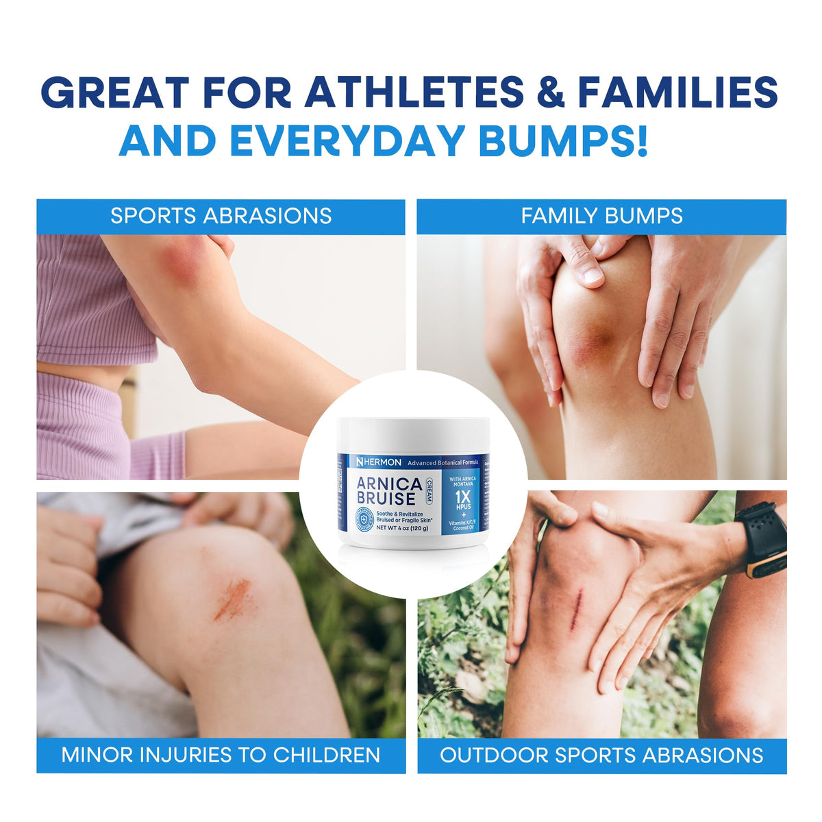 Hermon applied on forearm showing cosmetic improvement, visible coverage benefit