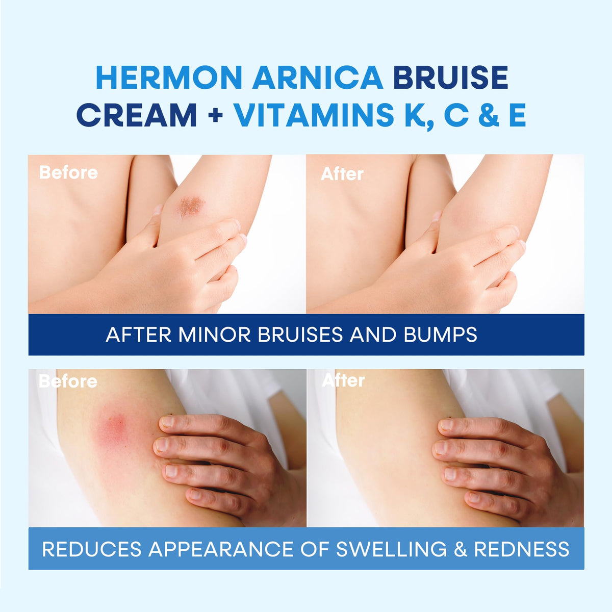 Hermon cream close-up texture detail, smooth non-greasy finish benefit