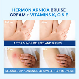 Hermon cream close-up texture detail, smooth non-greasy finish benefit