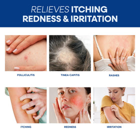 Hermon cream being applied to facial area for targeted soothing benefit