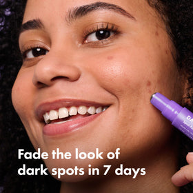 HERO COSMETICS stainless-steel rollerball close-up for accurate spot targeting