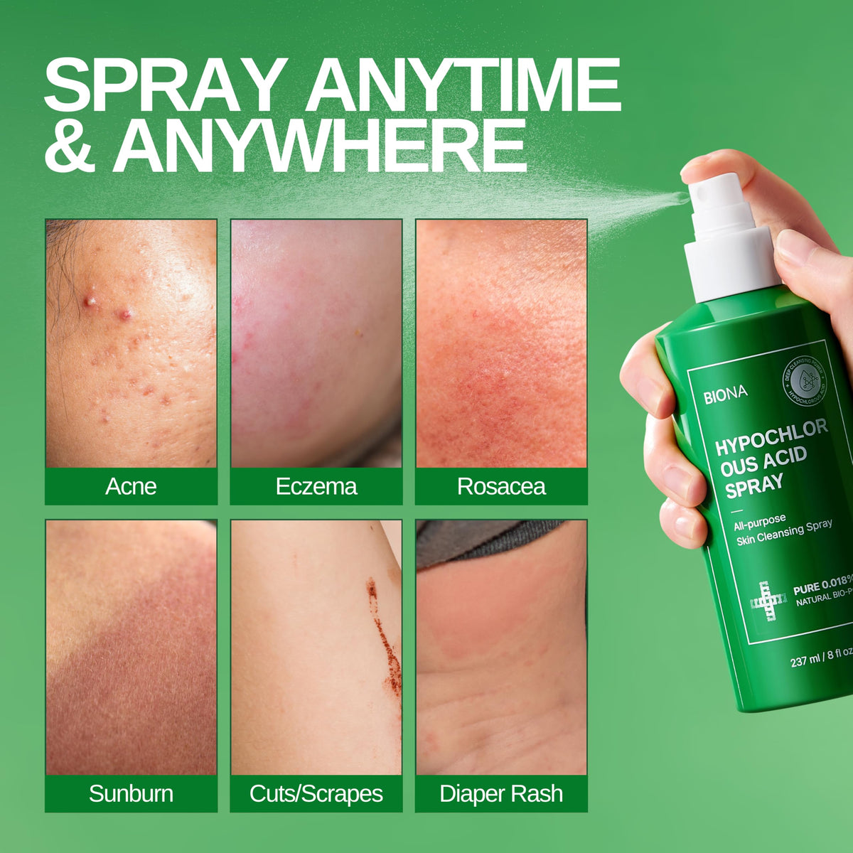 Honeydew Labs BIONA used for baby rash care on infant skin, gentle soothing benefit