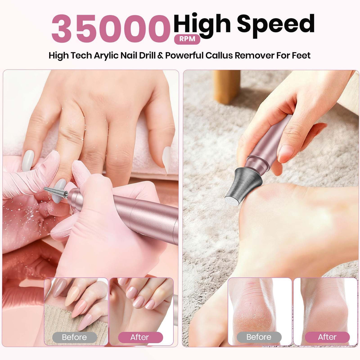 Hoxida LCD display and control buttons for precise speed selection