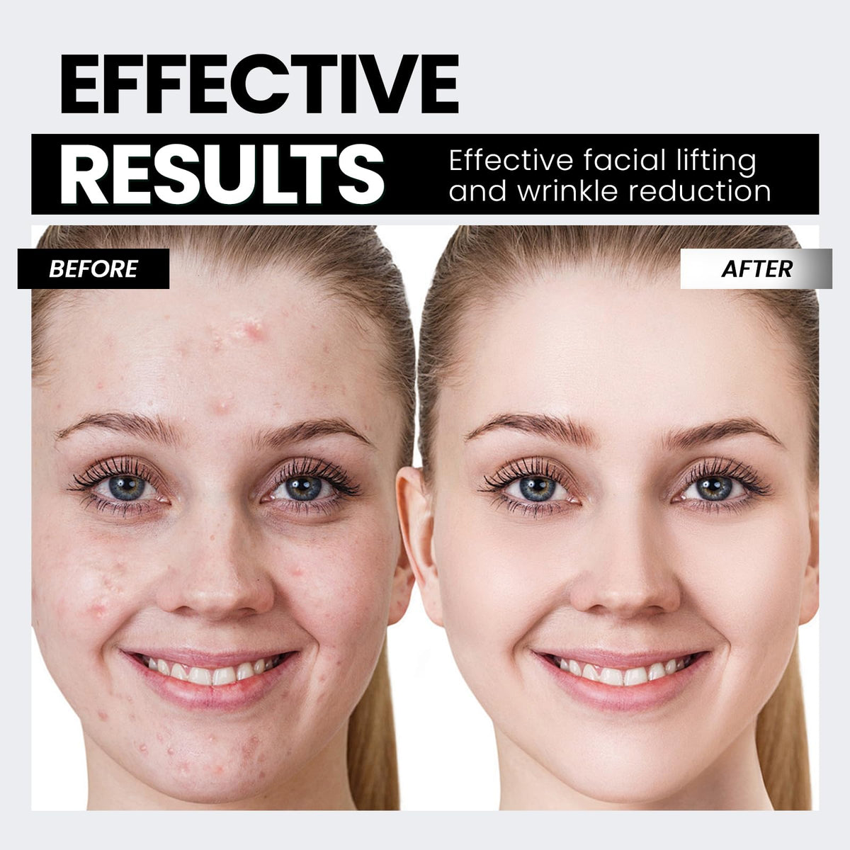 Hunvva EP-300 used along jawline illustrating lifting and contouring benefit