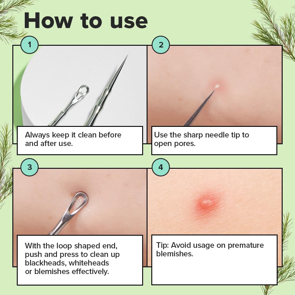 I DEW CARE close-up of loop end demonstrating even pressure extraction and gentle blackhead removal