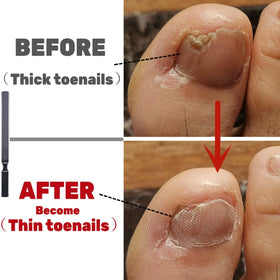 IDOU demonstrated on a dog nail showing safe, effective trimming for pet owners