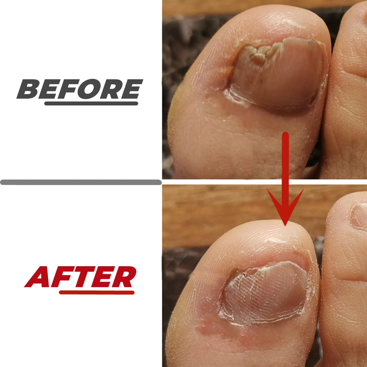 IDOU file in use on a dog nail demonstrating safe reduction of thick pet nails