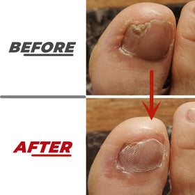 IDOU file in use on a dog nail demonstrating safe reduction of thick pet nails