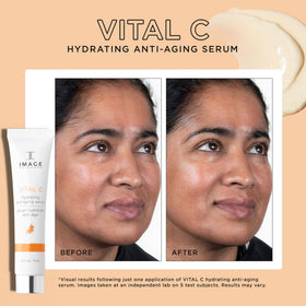 IMAGE Skincare serum texture on hand demonstrating lightweight, hydrating finish