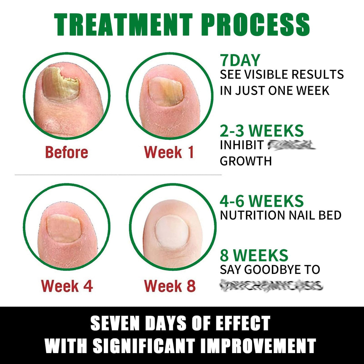 IMOLL applied to cuticle with gentle massage for hydration benefit