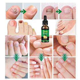 IMOLL dropper releasing oil highlighting precise application control