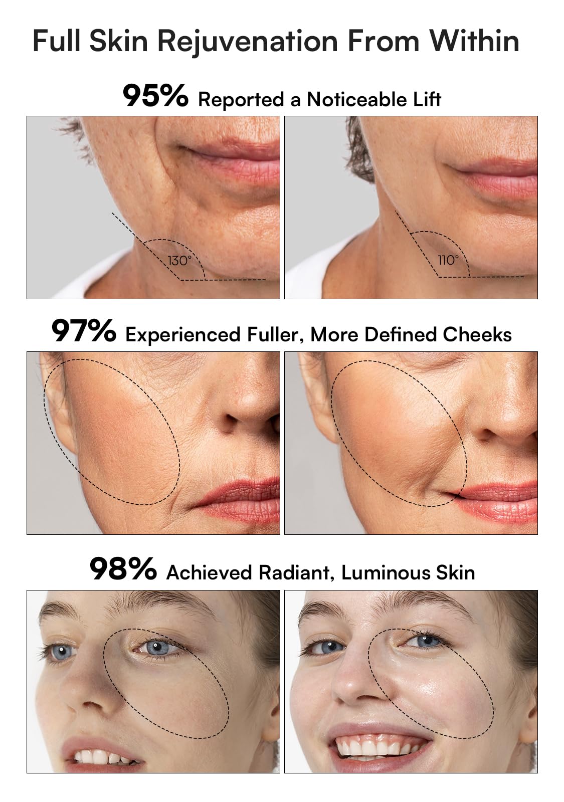 INIA device beside included hydrating gel to improve product absorption