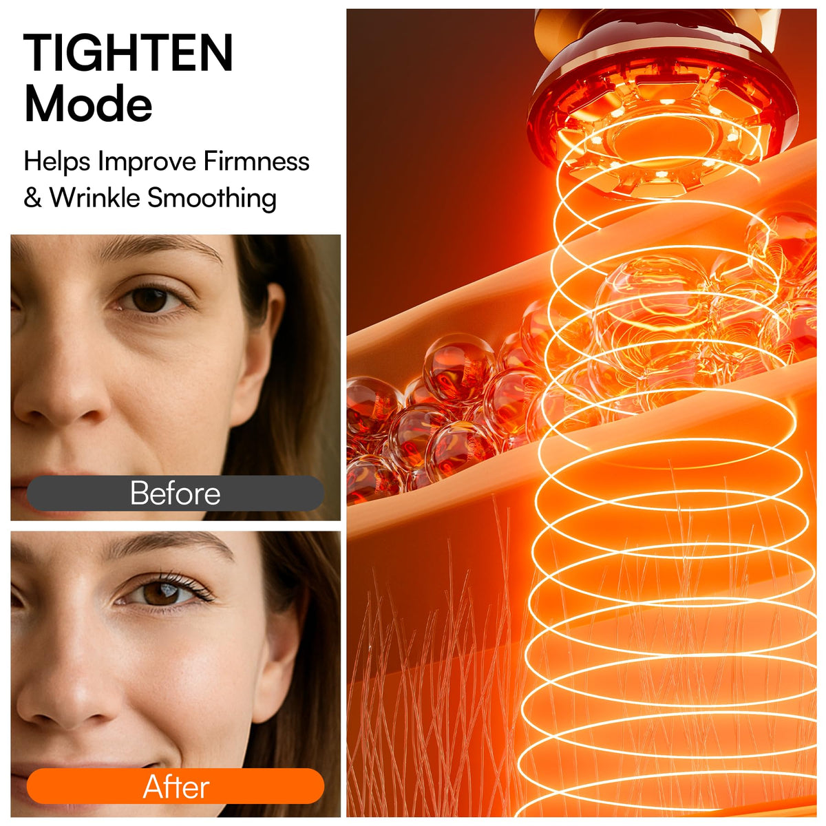 INIA device with hydrating gel to enhance absorption and smoother glide
