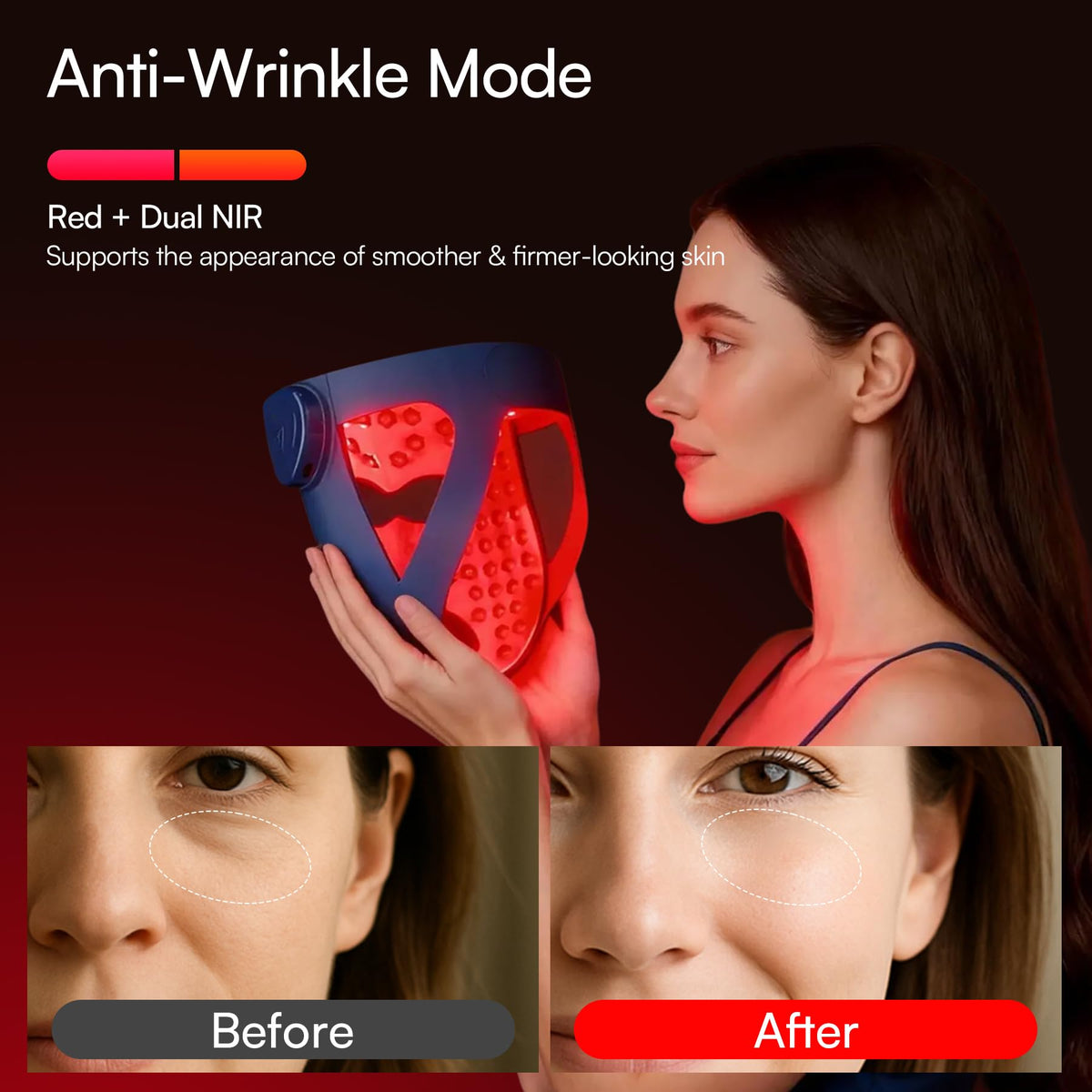 INIA profile view on model showing 4D silicone contour for closer contact