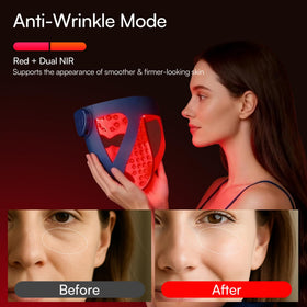 INIA profile view on model showing 4D silicone contour for closer contact