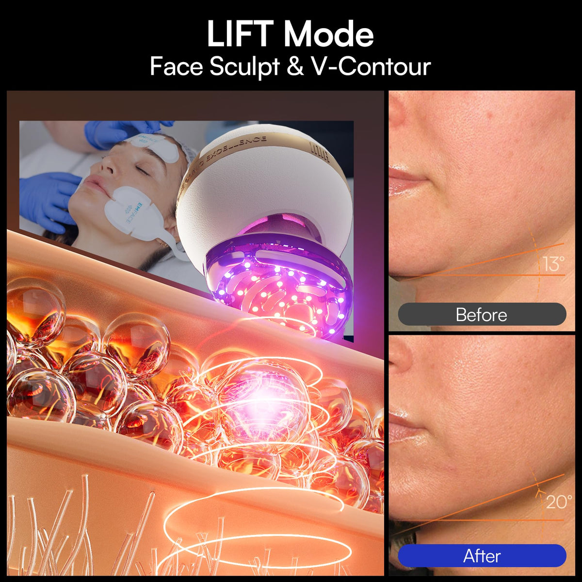 INIA SPHERA in use on cheek to define contours and stimulate skin