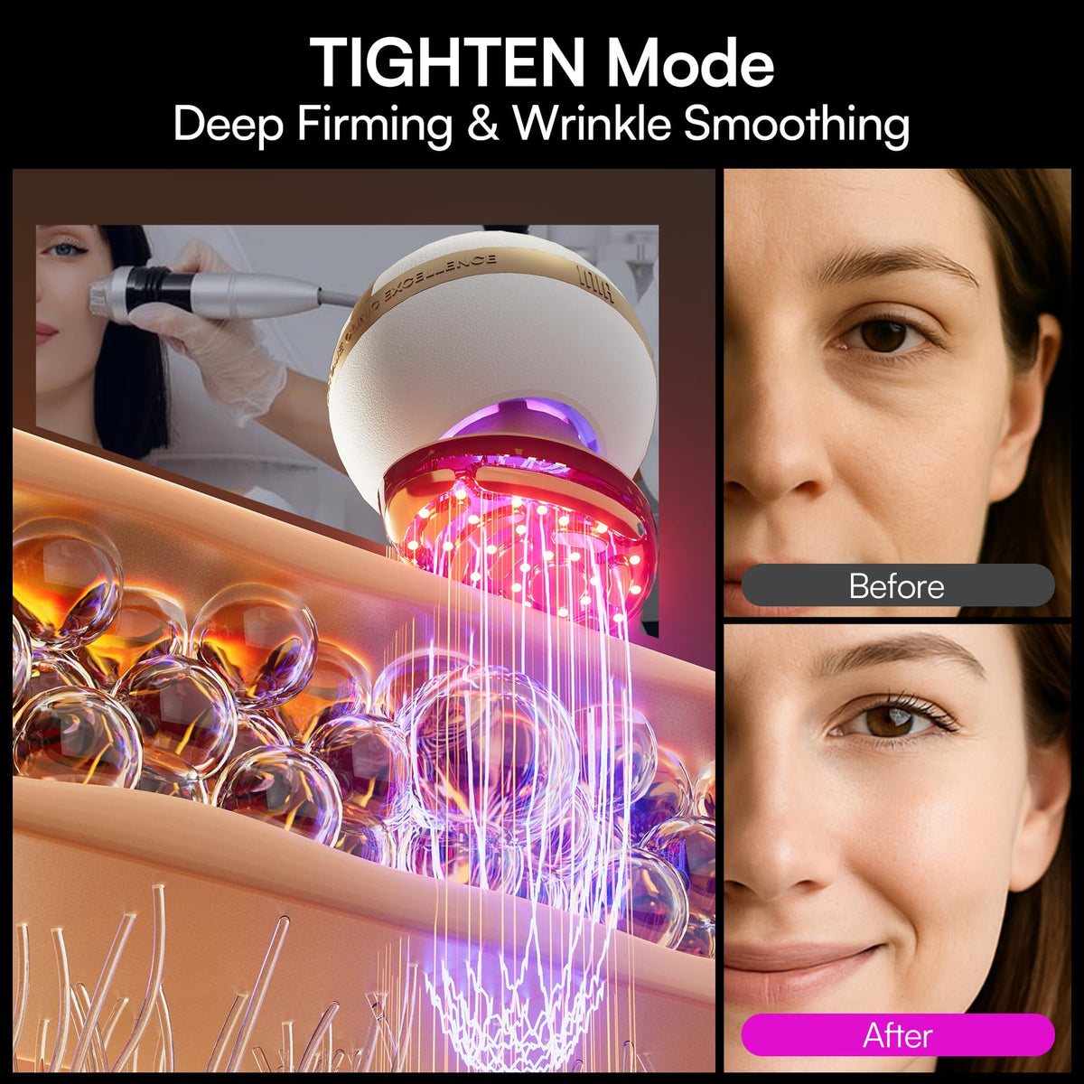 INIA SPHERA used along neck to lift and improve skin appearance