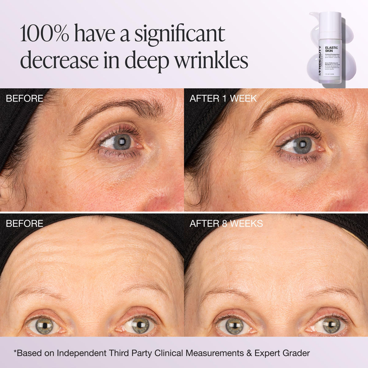 INNBEAUTY Project styled before-and-after sample suggesting improved elasticity benefit